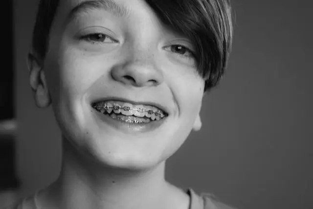 How Much Do Braces Cost and What Influences Their Price?