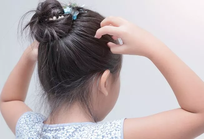 How to Get Rid of Lice Super Fast - Best Natural Remedies