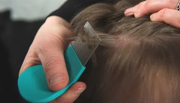 What Happens If You Have Head Lice For Too Long?