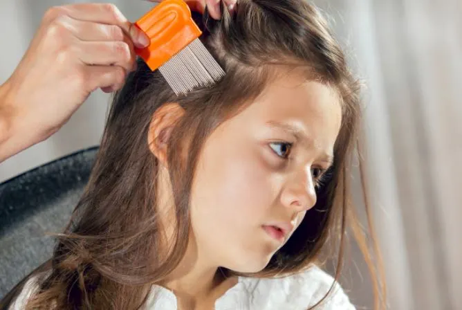 How Long Can Dead Nits Stay in Hair After Lice Removal Treatment?