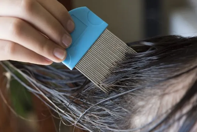 How to Remove Dead Lice Eggs From Hair?