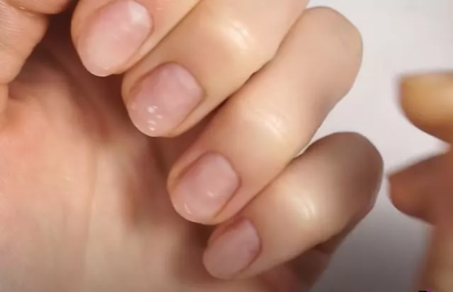 How to Get Rid of Green Nails After False Nails?